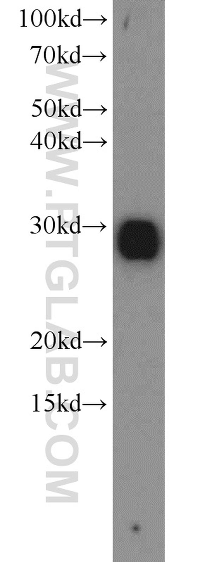 C14orf166 Antibody in Western Blot (WB)