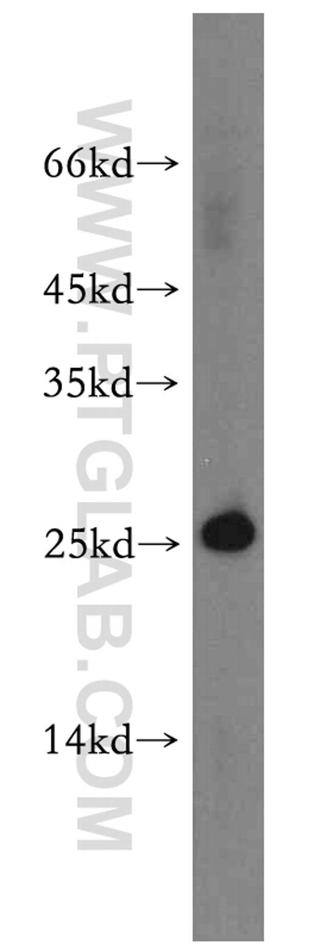 C14orf166 Antibody in Western Blot (WB)