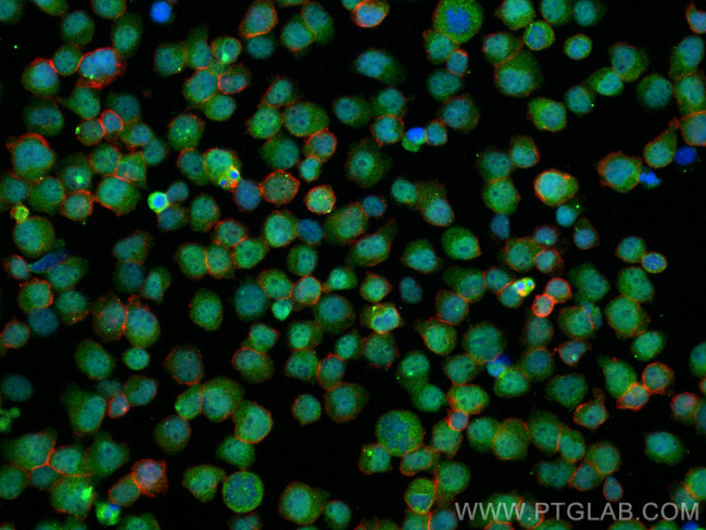 C14orf166 Antibody in Immunocytochemistry (ICC/IF)