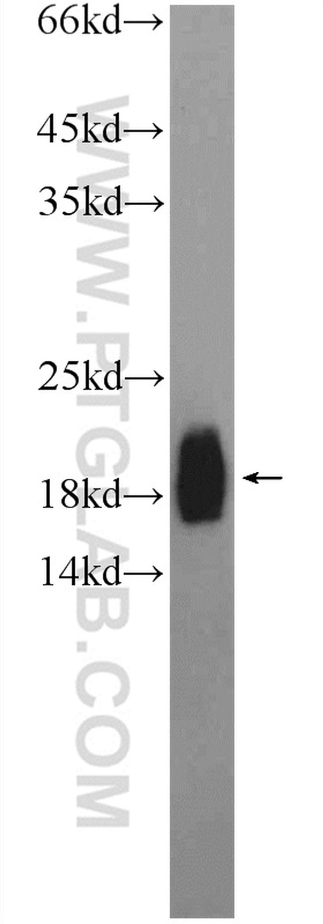 ZNF747 Antibody in Western Blot (WB)