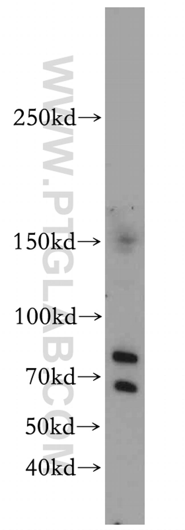 KDM3B Antibody in Western Blot (WB)