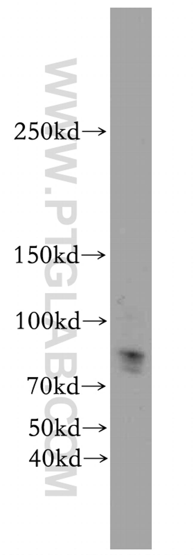 KDM3B Antibody in Western Blot (WB)