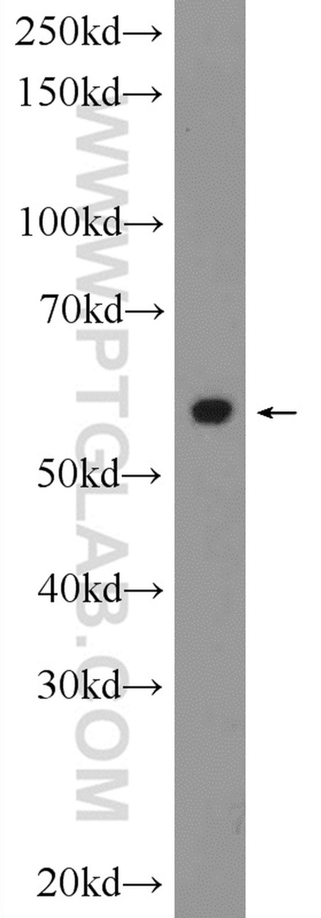 CYP2E1 Antibody in Western Blot (WB)