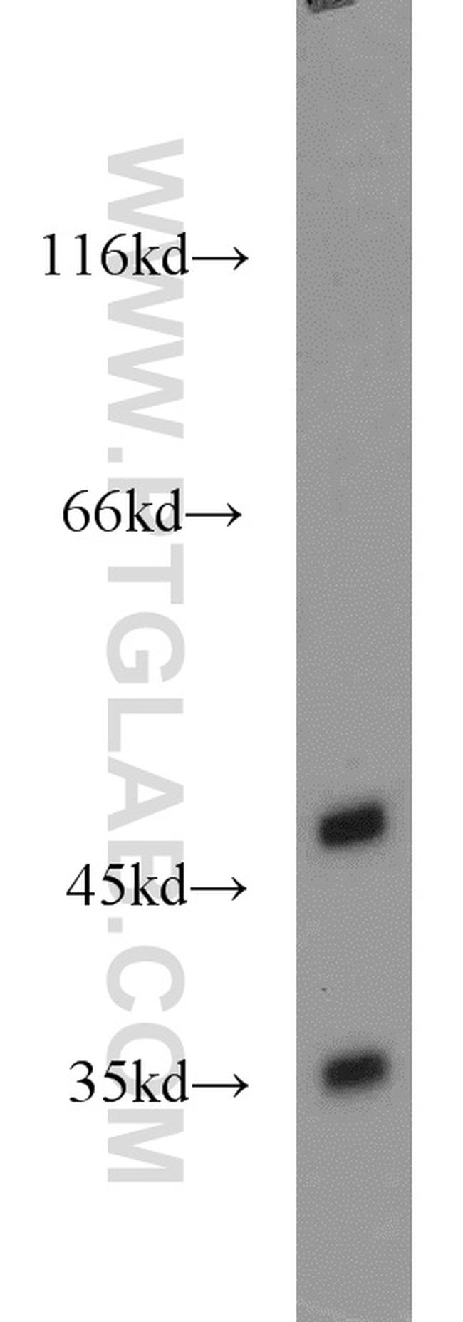 GPR22 Antibody in Western Blot (WB)