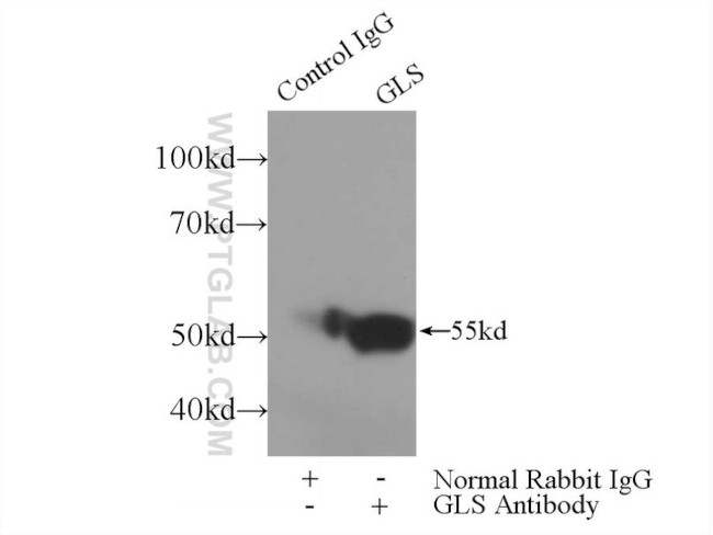 GAC Antibody in Immunoprecipitation (IP)
