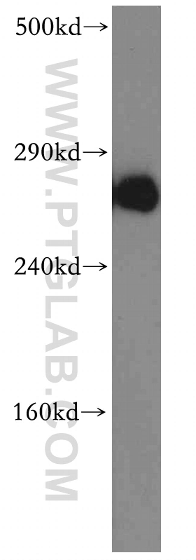 ITPR1 Antibody in Western Blot (WB)