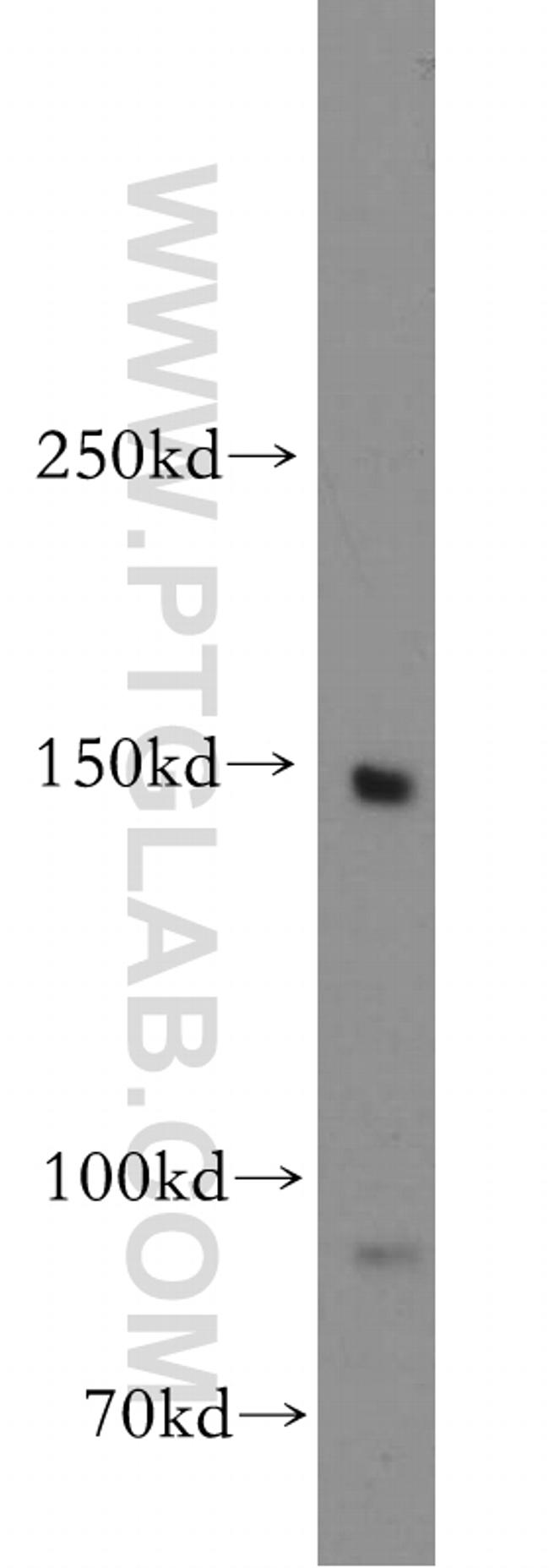 MYBPC3 Antibody in Western Blot (WB)