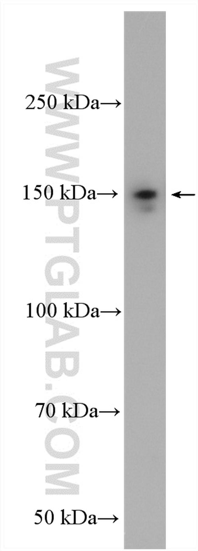 MYBPC3 Antibody in Western Blot (WB)