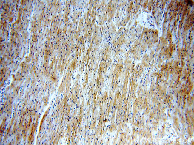 LDHA Antibody in Immunohistochemistry (Paraffin) (IHC (P))