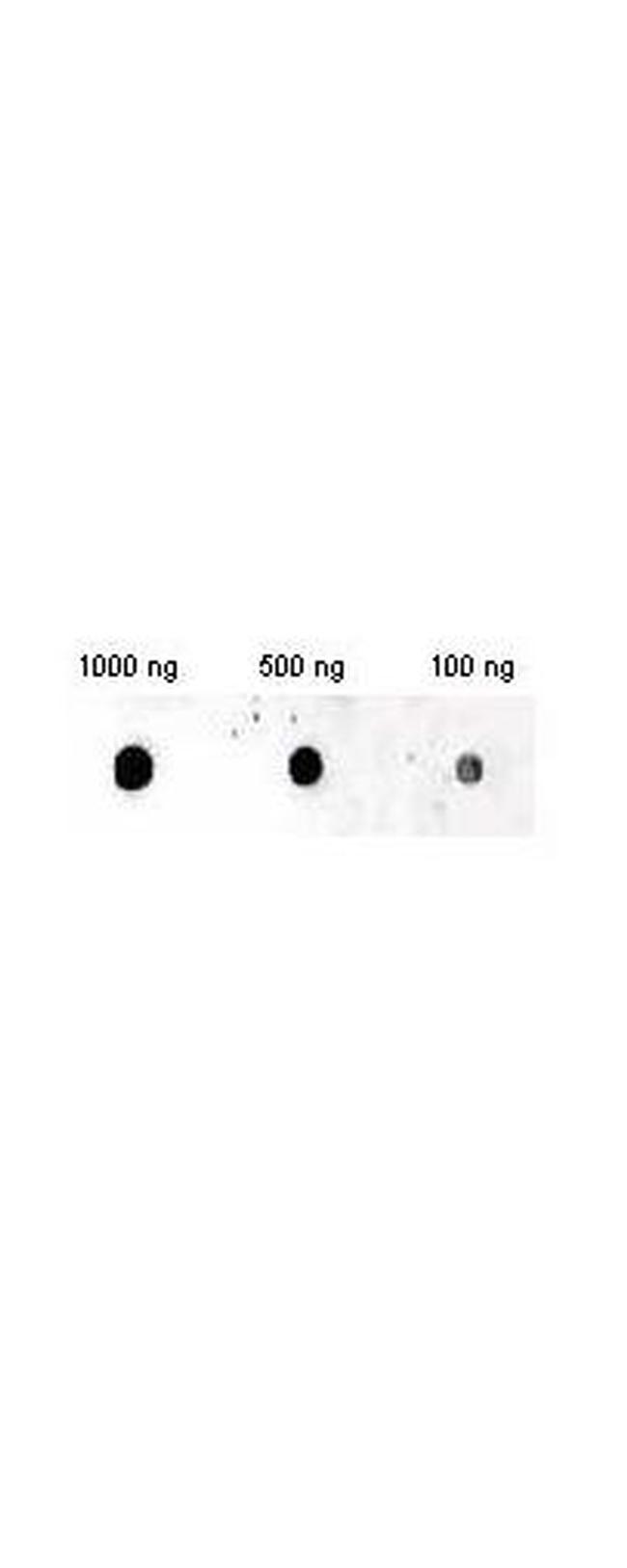 Insulin Antibody in Dot Blot (DB)