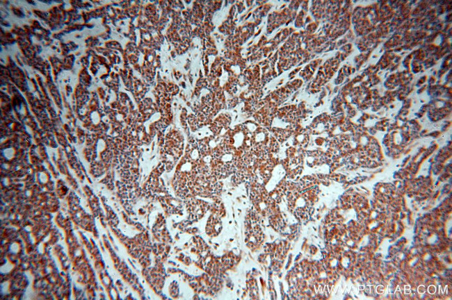 ZC3H4 Antibody in Immunohistochemistry (Paraffin) (IHC (P))