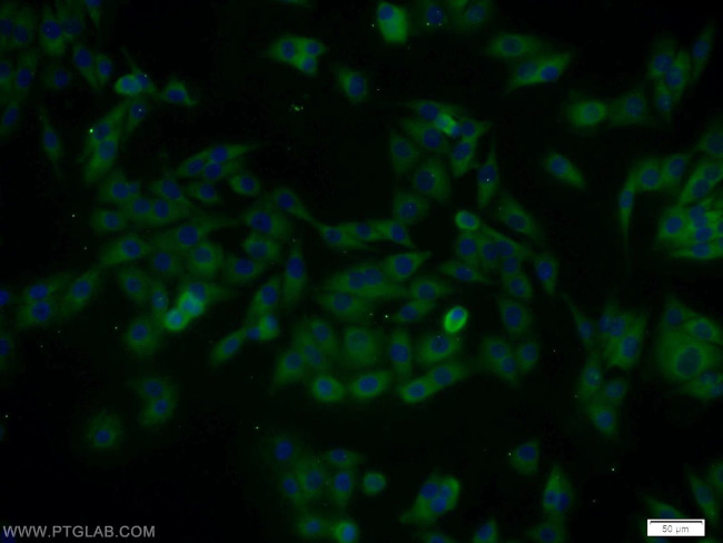 DAPK2 Antibody in Immunocytochemistry (ICC/IF)