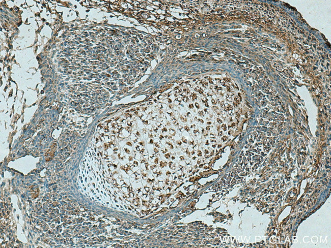 TNS3 Antibody in Immunohistochemistry (Paraffin) (IHC (P))