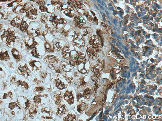 TNS3 Antibody in Immunohistochemistry (Paraffin) (IHC (P))