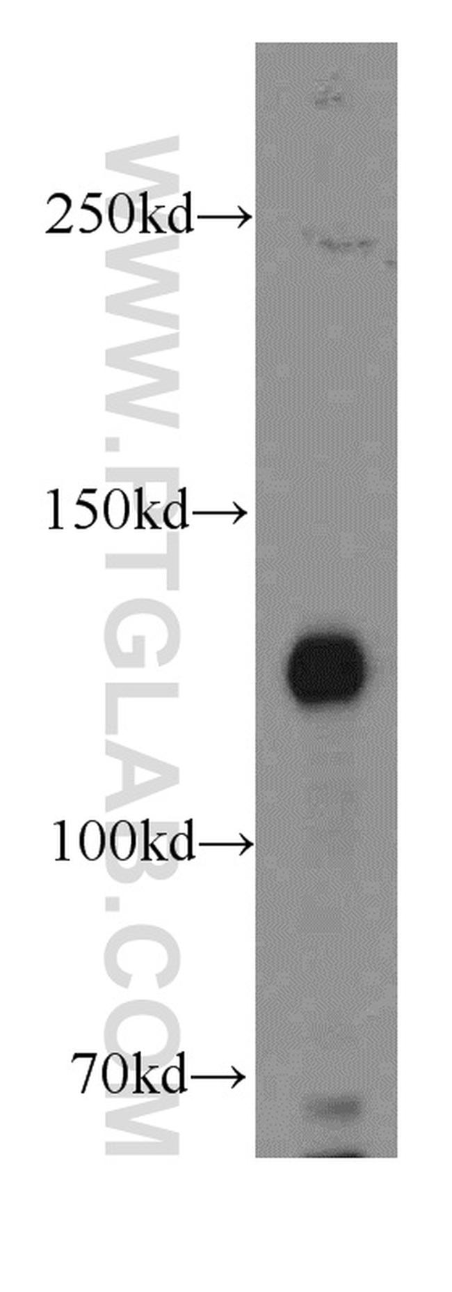 TNS3 Antibody in Western Blot (WB)