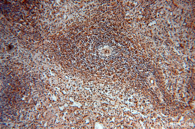 MYSM1 Antibody in Immunohistochemistry (Paraffin) (IHC (P))