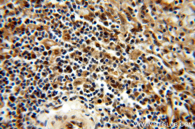 MYSM1 Antibody in Immunohistochemistry (Paraffin) (IHC (P))