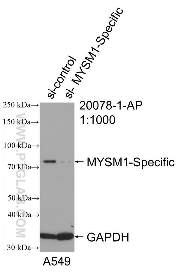 MYSM1 Antibody in Western Blot (WB)