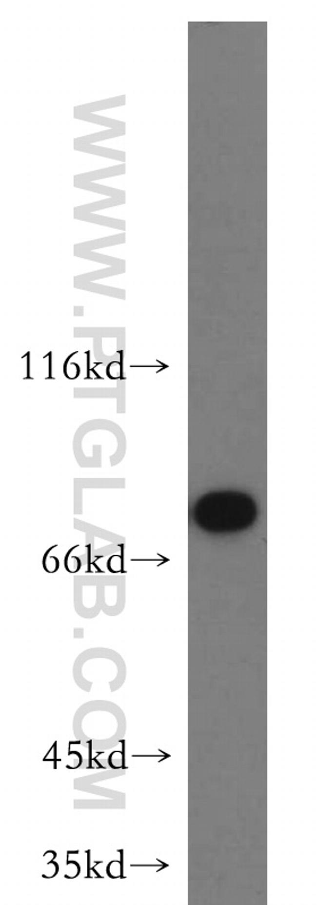 MYSM1 Antibody in Western Blot (WB)