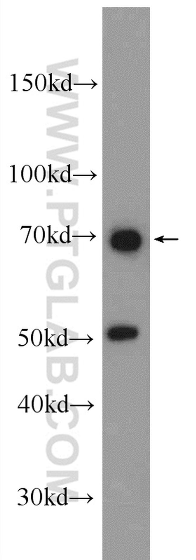 MYSM1 Antibody in Western Blot (WB)