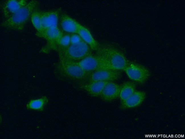 GAB3 Antibody in Immunocytochemistry (ICC/IF)