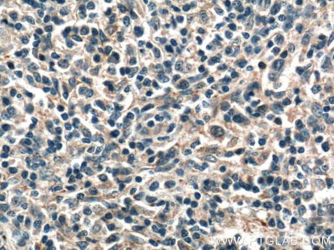 CD45 Antibody in Immunohistochemistry (Paraffin) (IHC (P))