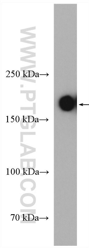 CD45 Antibody in Western Blot (WB)