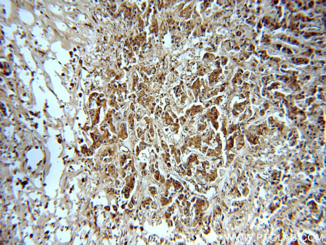 EEF2 Antibody in Immunohistochemistry (Paraffin) (IHC (P))