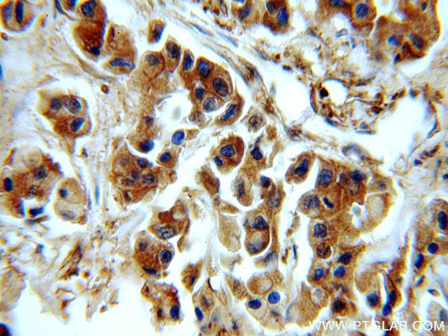 EEF2 Antibody in Immunohistochemistry (Paraffin) (IHC (P))