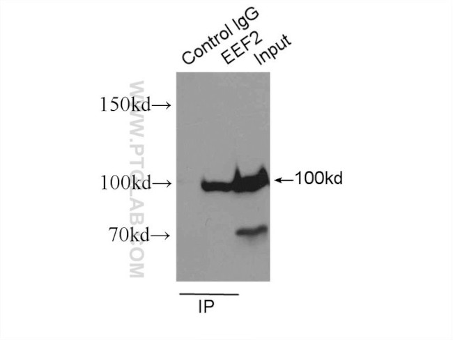 EEF2 Antibody in Immunoprecipitation (IP)