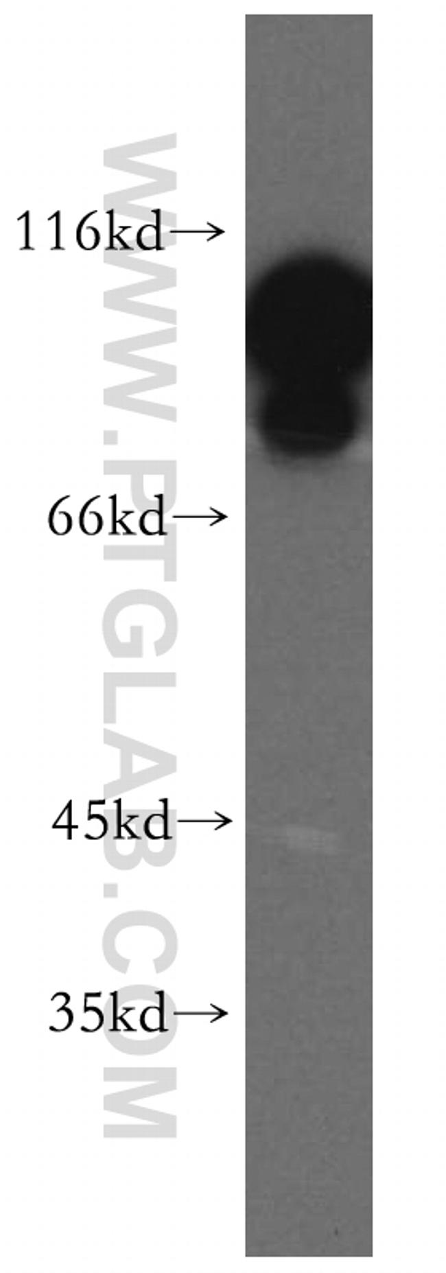 EEF2 Antibody in Western Blot (WB)