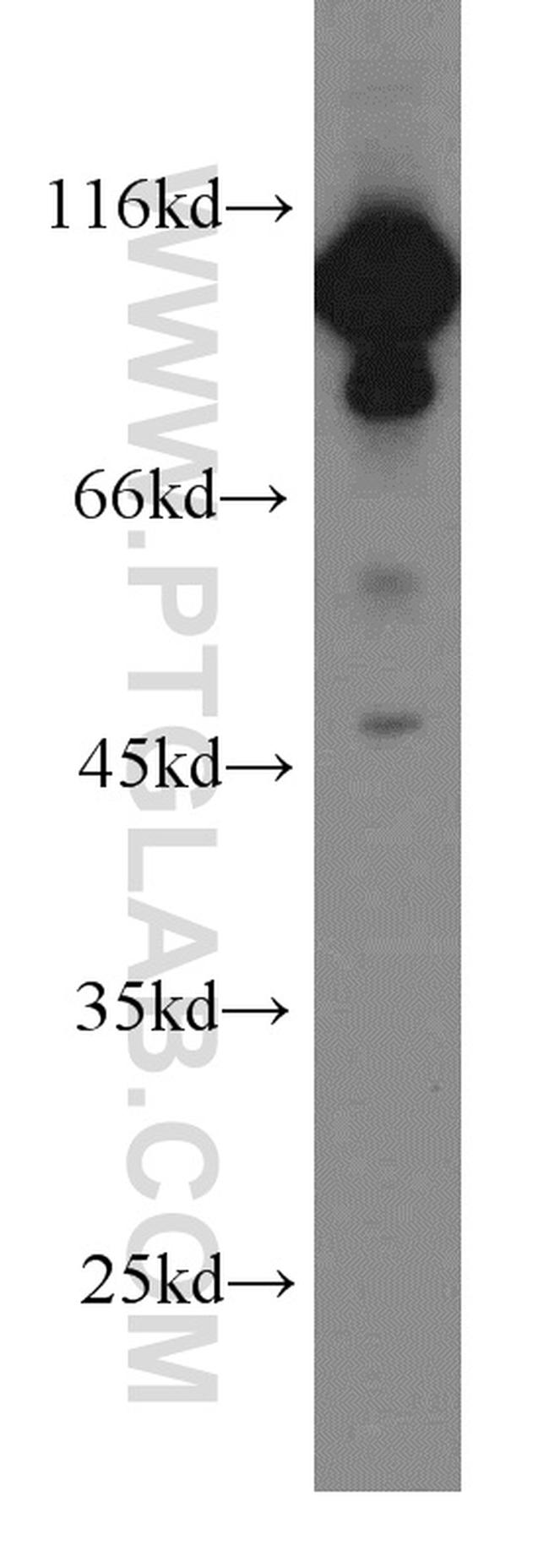 EEF2 Antibody in Western Blot (WB)