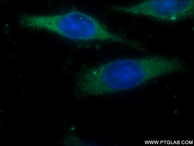 OVCA1 Antibody in Immunocytochemistry (ICC/IF)