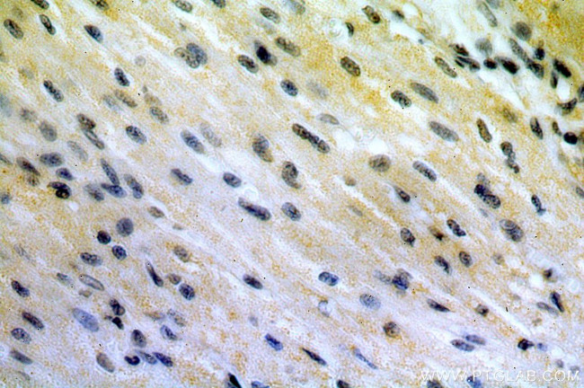 OVCA1 Antibody in Immunohistochemistry (Paraffin) (IHC (P))