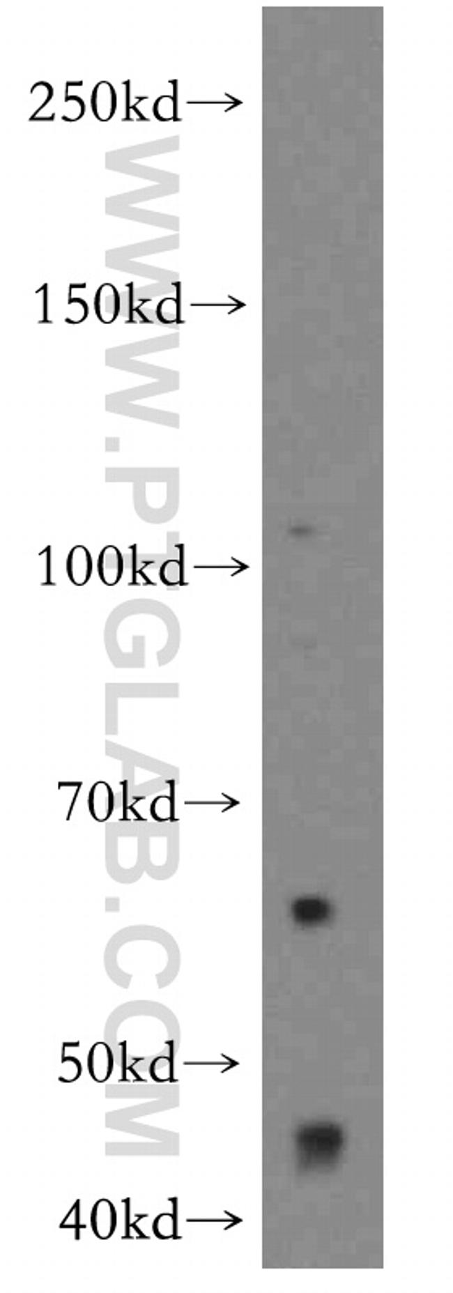 OVCA1 Antibody in Western Blot (WB)