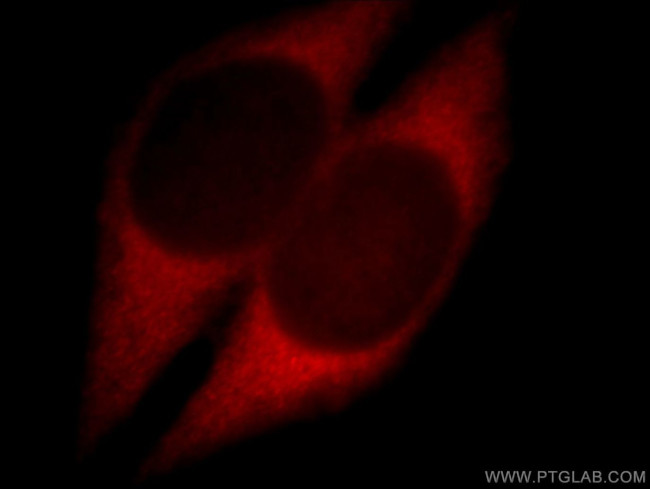 ZCCHC11 Antibody in Immunocytochemistry (ICC/IF)