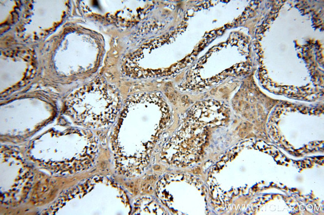 ZCCHC11 Antibody in Immunohistochemistry (Paraffin) (IHC (P))