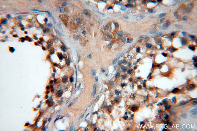 ZCCHC11 Antibody in Immunohistochemistry (Paraffin) (IHC (P))