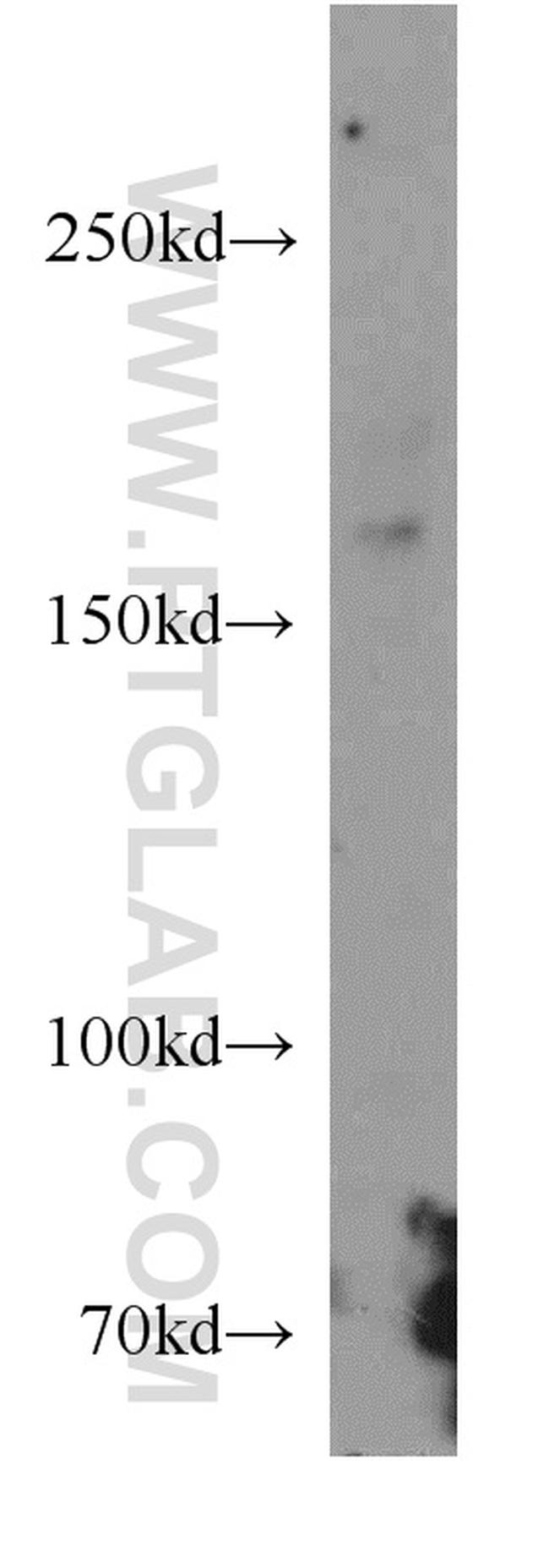 ZCCHC11 Antibody in Western Blot (WB)