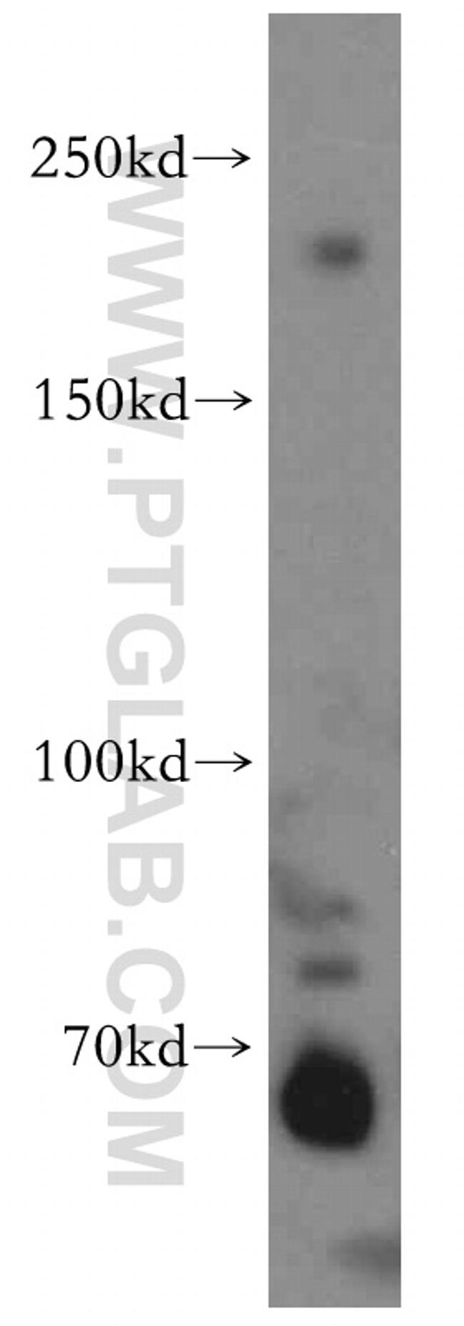 ZCCHC11 Antibody in Western Blot (WB)