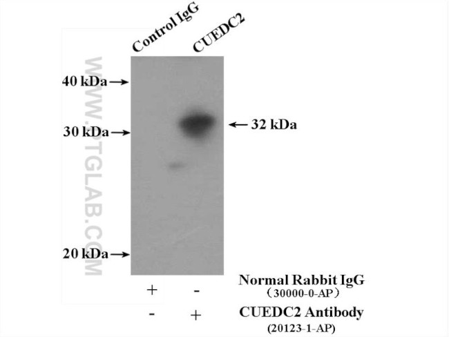 CUEDC2 Antibody in Immunoprecipitation (IP)