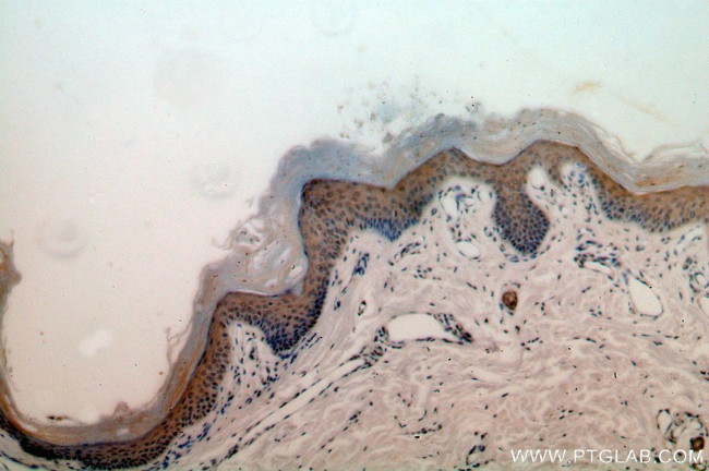 RRP8 Antibody in Immunohistochemistry (Paraffin) (IHC (P))