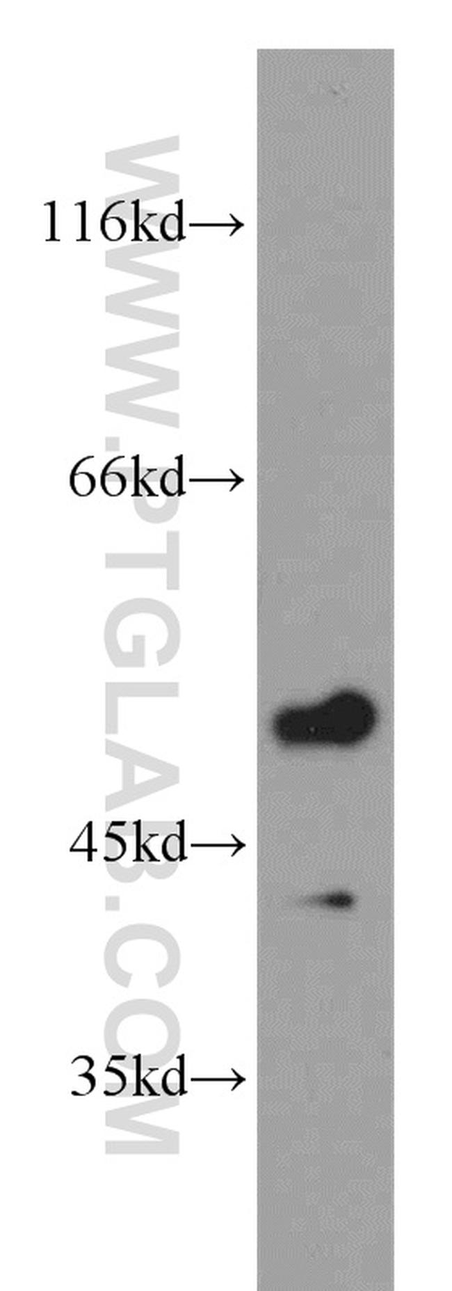 RRP8 Antibody in Western Blot (WB)