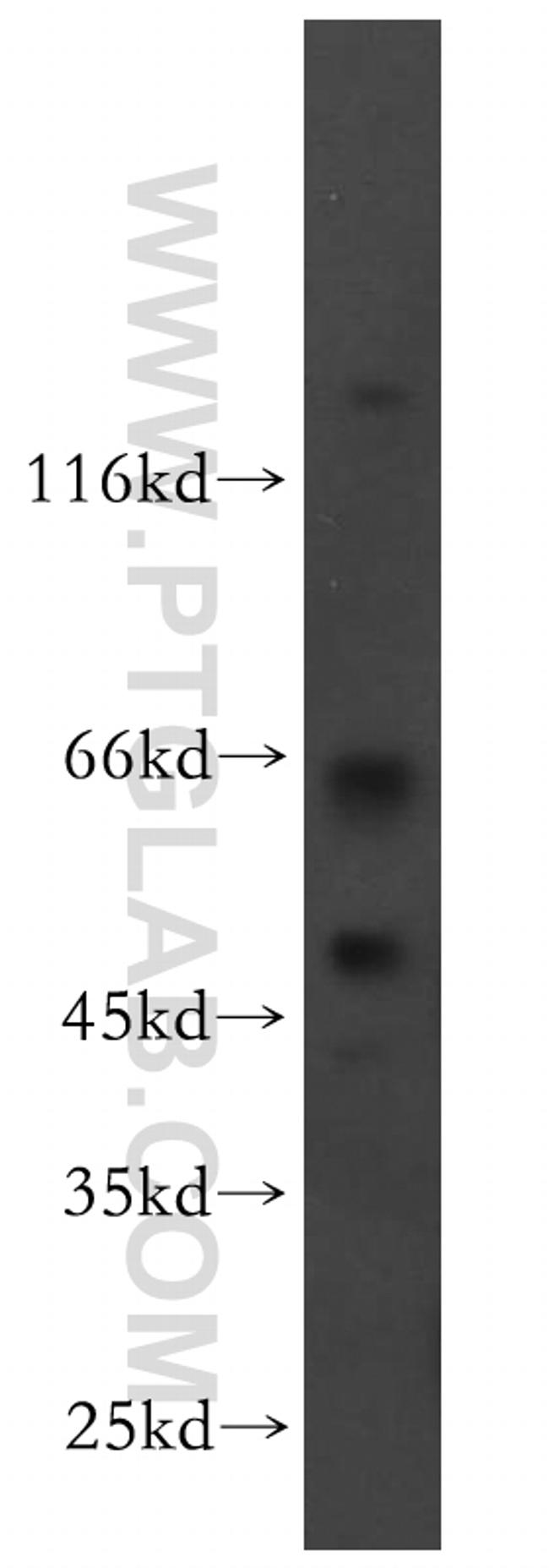RRP8 Antibody in Western Blot (WB)
