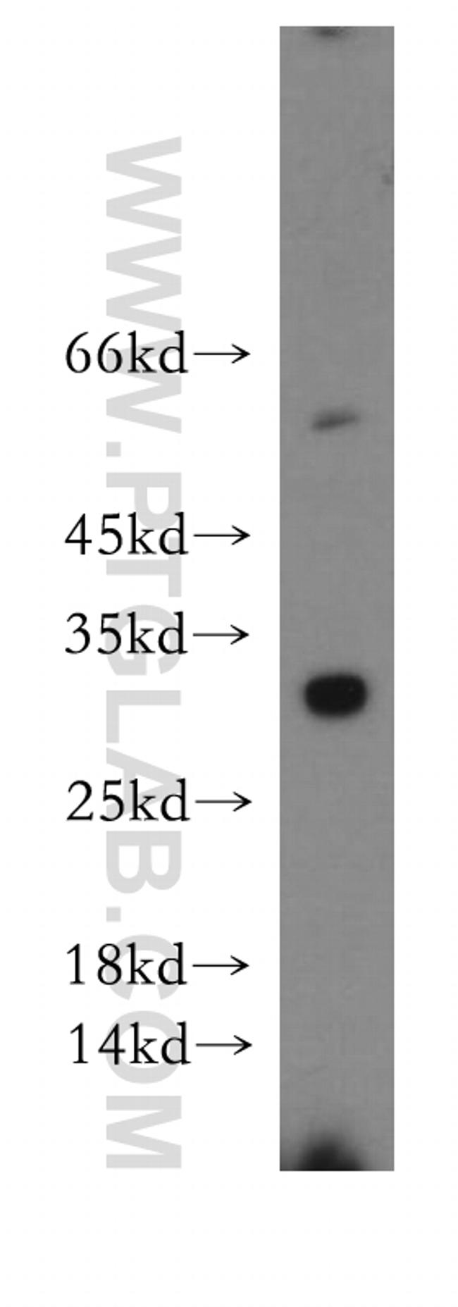 BIRC8 Antibody in Western Blot (WB)