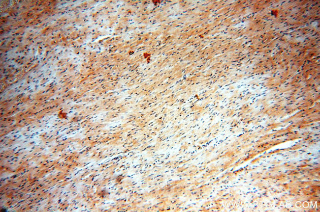 SHP2 Antibody in Immunohistochemistry (Paraffin) (IHC (P))