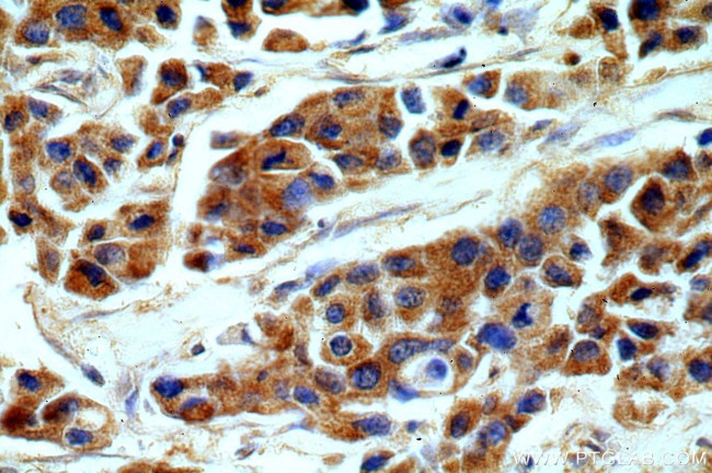 SHP2 Antibody in Immunohistochemistry (Paraffin) (IHC (P))