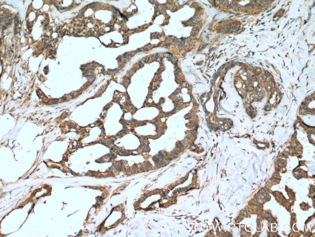 SHP2 Antibody in Immunohistochemistry (Paraffin) (IHC (P))