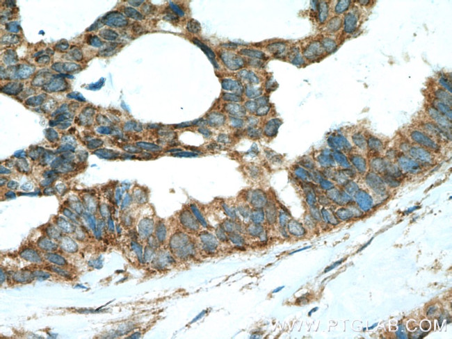 SHP2 Antibody in Immunohistochemistry (Paraffin) (IHC (P))