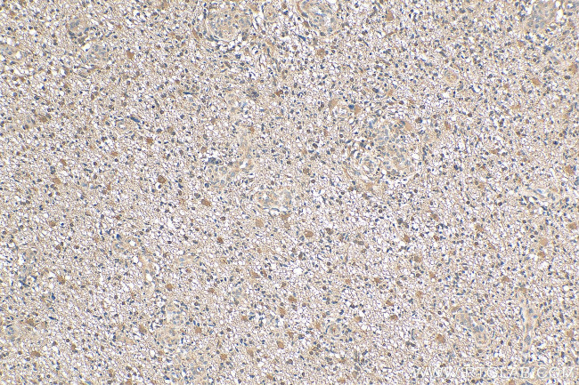 SHP2 Antibody in Immunohistochemistry (Paraffin) (IHC (P))